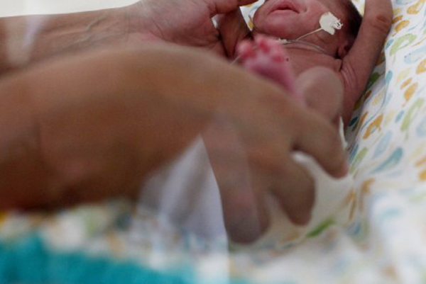 Novo estudo aponta que as chances de um bebê ter microcefalia são multiplicadas se a mãe for contaminada pelo zika vírus (Foto: Banco de Dados)
