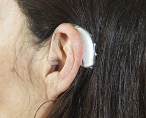 Novos aparelhos auditivos trazem mais recursos e facilidades de adaptação (Foto: Divulgação)