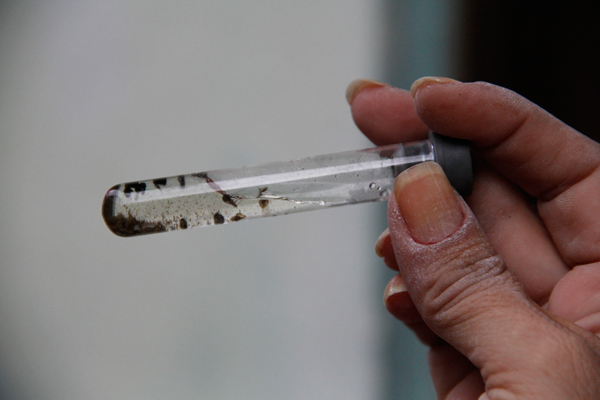 Zika exige maior número de exames (Foto: Banco de Dados)